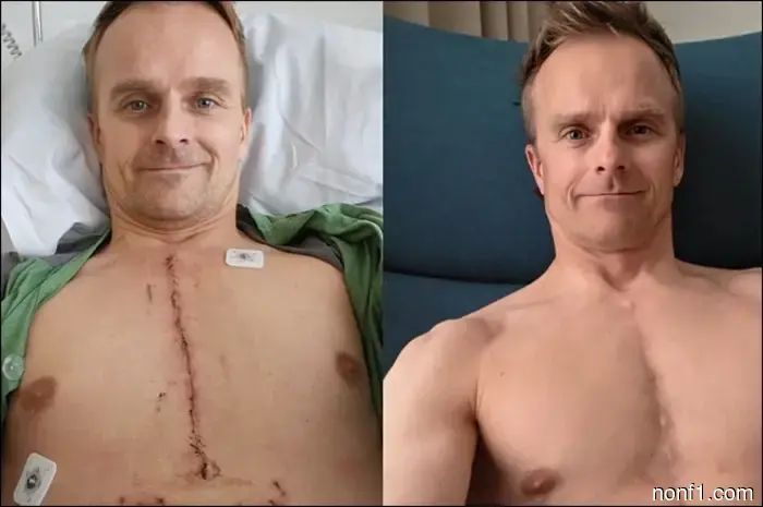 Kovalainen: Siempre estaré agradecido a los médicos